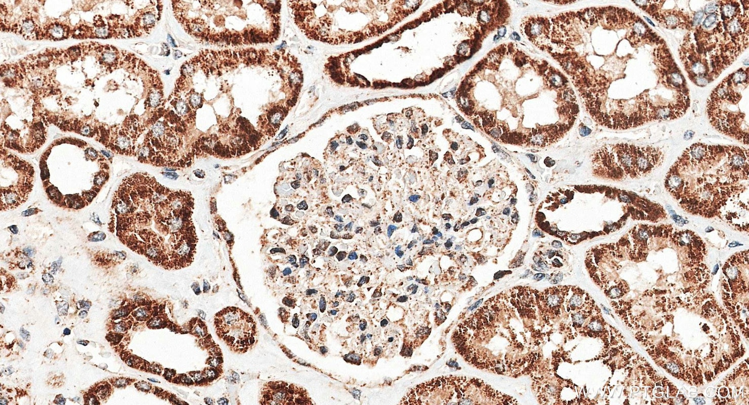 Immunohistochemistry (IHC) staining of human kidney tissue using PNPT1 Polyclonal antibody (14487-1-AP)