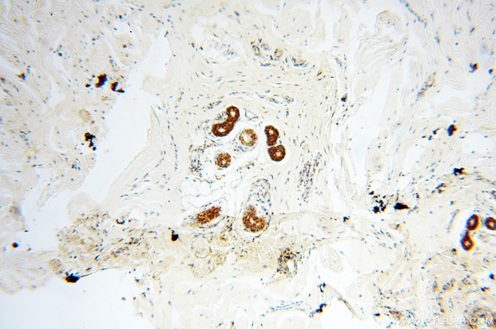 Immunohistochemistry (IHC) staining of human skin tissue using PNPT1 Polyclonal antibody (14487-1-AP)