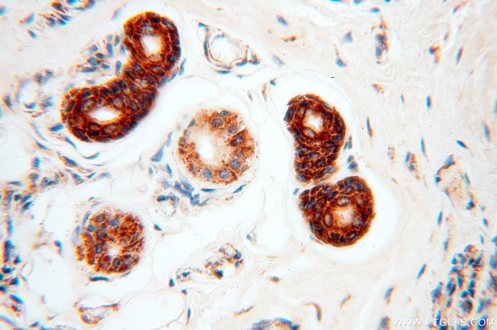 IHC staining of human skin using 14487-1-AP