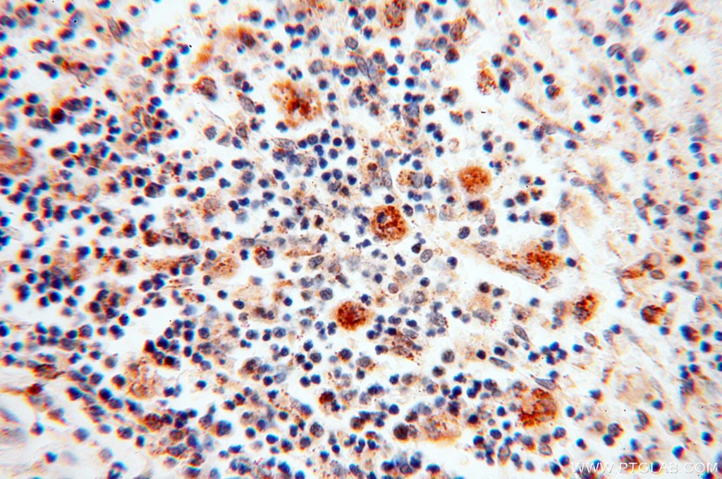 Immunohistochemistry (IHC) staining of human spleen tissue using PNPT1 Polyclonal antibody (14487-1-AP)