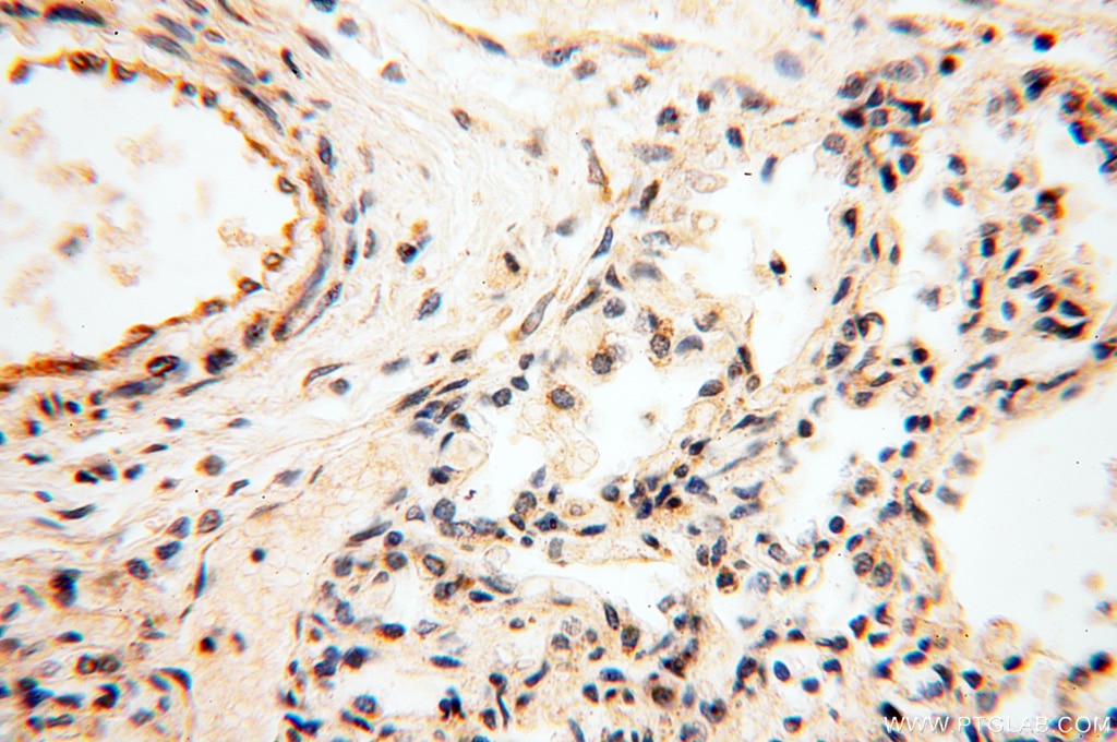 Immunohistochemistry (IHC) staining of human lung tissue using PNPT1 Polyclonal antibody (14487-1-AP)