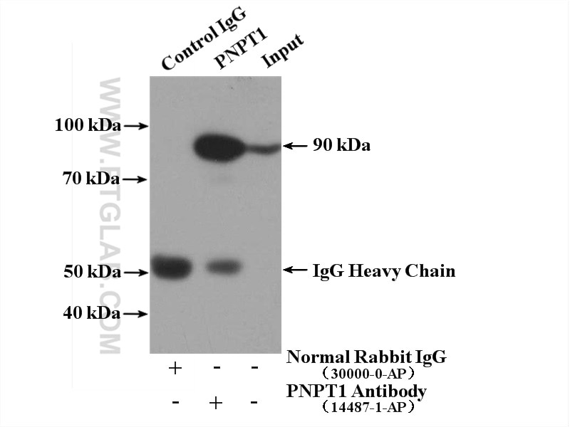 Immunoprecipitation (IP) experiment of mouse brain tissue using PNPT1 Polyclonal antibody (14487-1-AP)