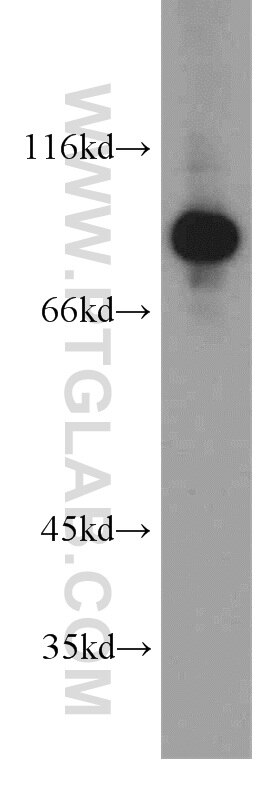 Western Blot (WB) analysis of human brain tissue using PNPT1 Polyclonal antibody (14487-1-AP)