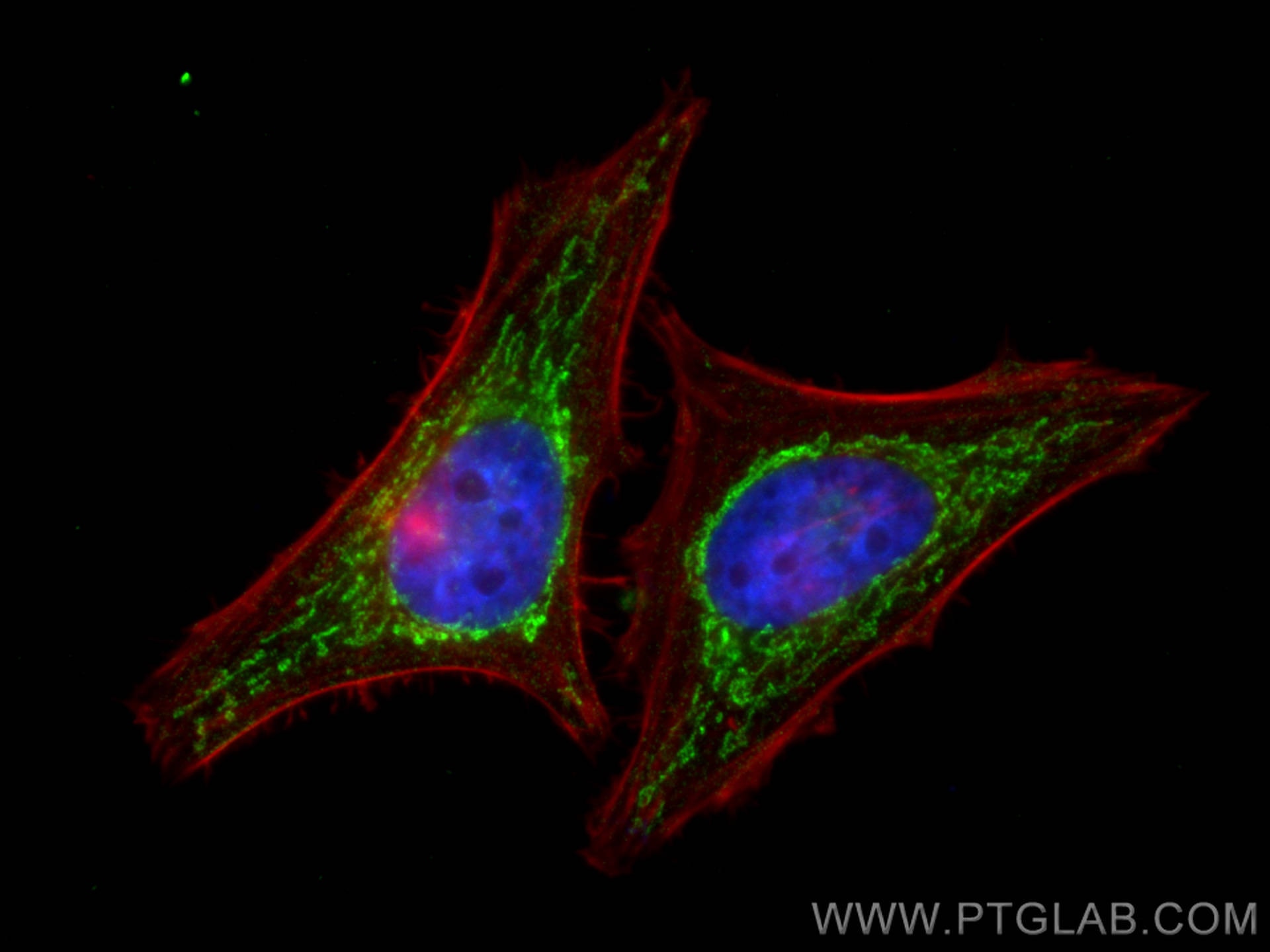 Immunofluorescence (IF) / fluorescent staining of HeLa cells using PNPT1 Monoclonal antibody (68309-1-Ig)