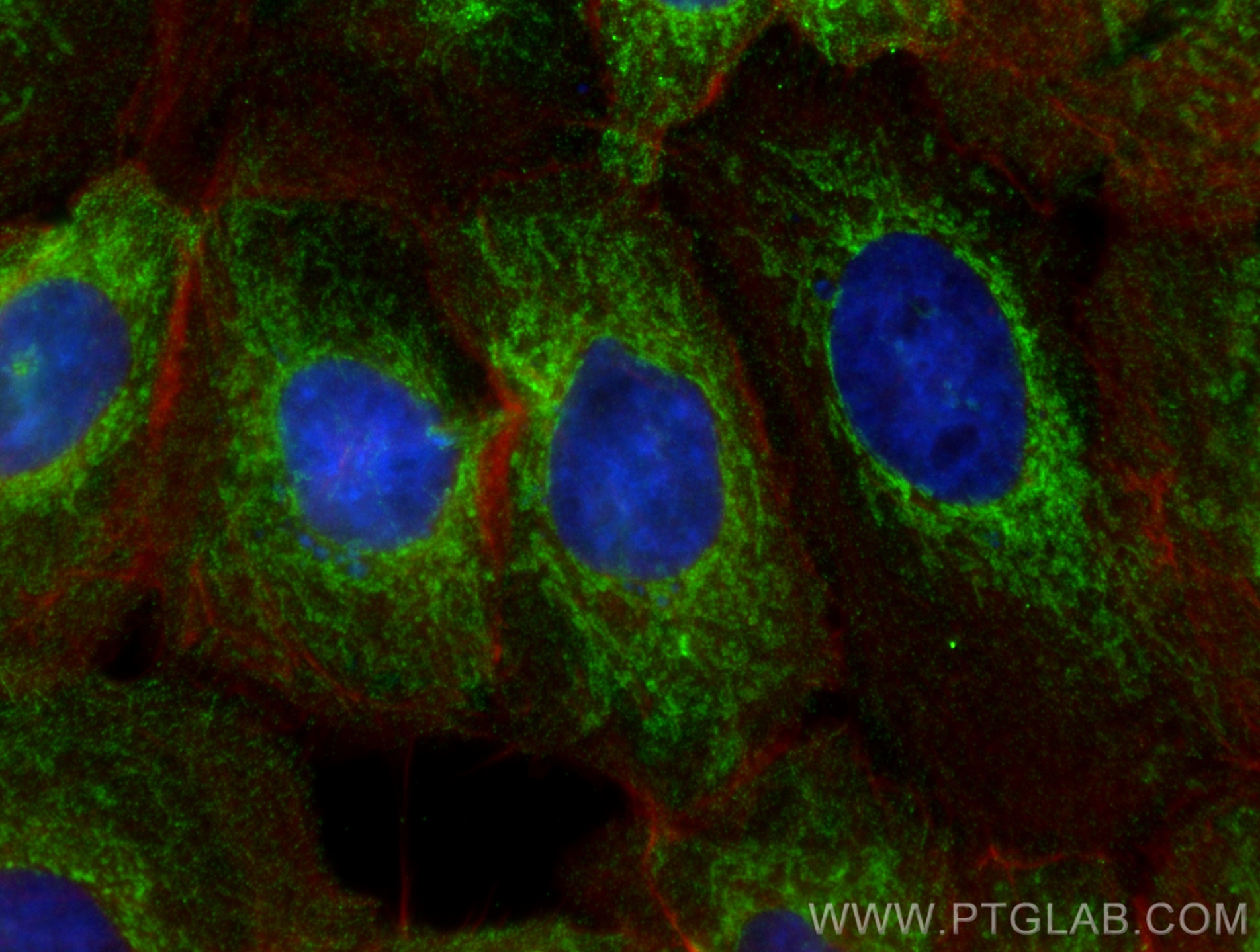 Immunofluorescence (IF) / fluorescent staining of A431 cells using CoraLite® Plus 488-conjugated PNPT1 Monoclonal ant (CL488-68309)