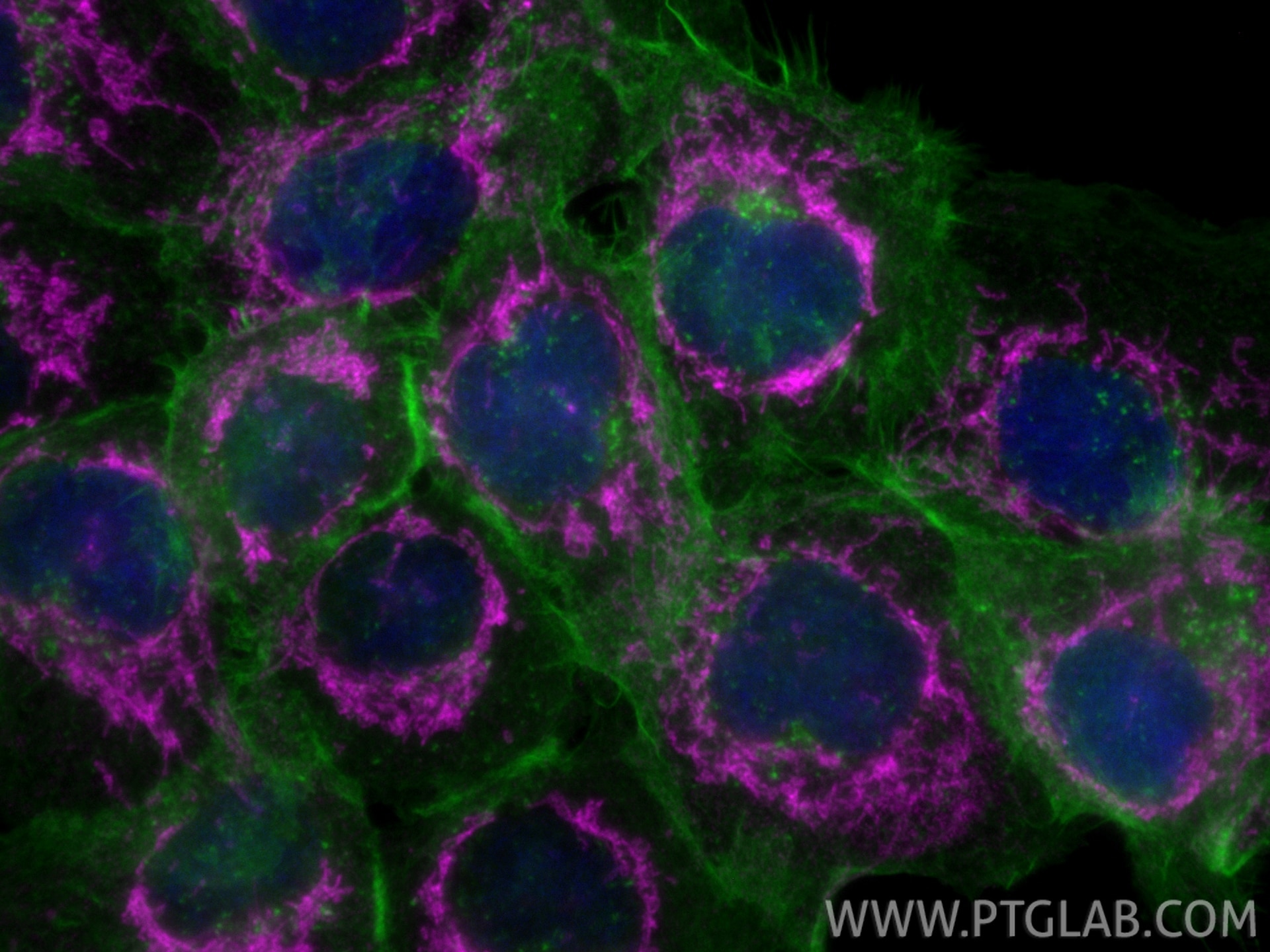 Immunofluorescence (IF) / fluorescent staining of A431 cells using CoraLite® Plus 647-conjugated PNPT1 Monoclonal ant (CL647-68309)