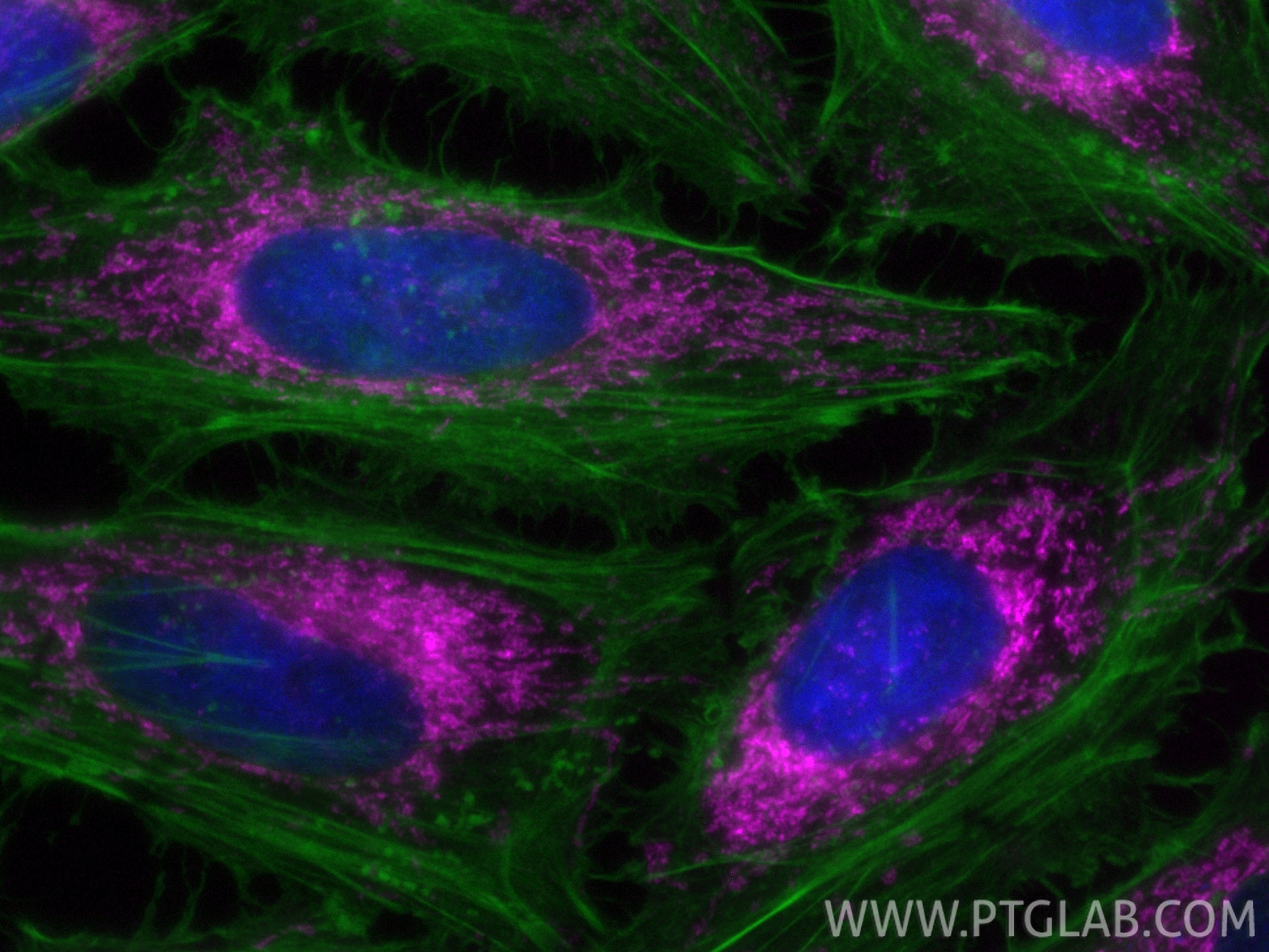 Immunofluorescence (IF) / fluorescent staining of HeLa cells using CoraLite® Plus 647-conjugated PNPT1 Monoclonal ant (CL647-68309)