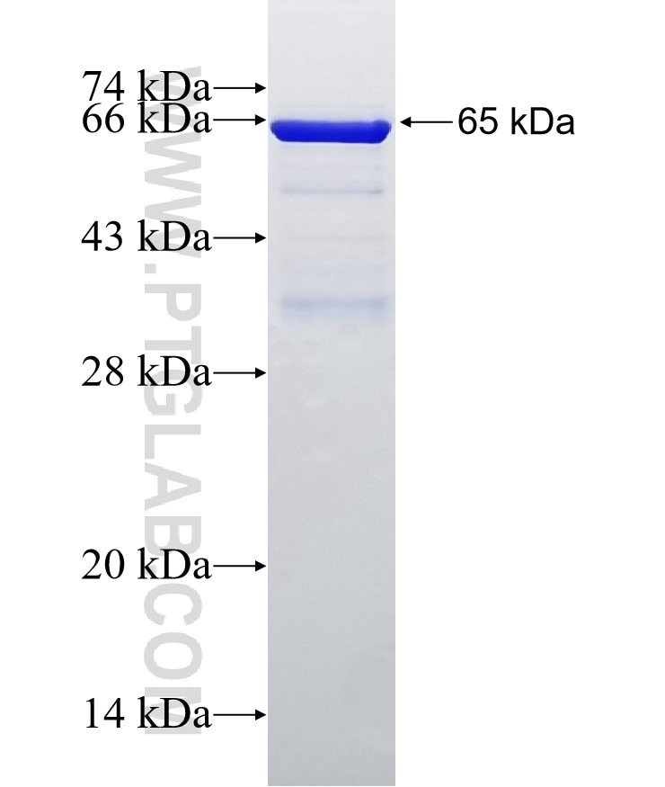PNPT1 fusion protein Ag5888 SDS-PAGE