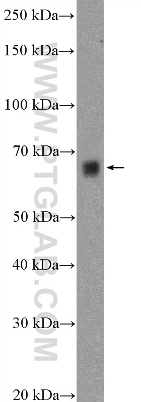 Western Blot (WB) analysis of mouse kidney tissue using PODN Polyclonal antibody (15014-1-AP)