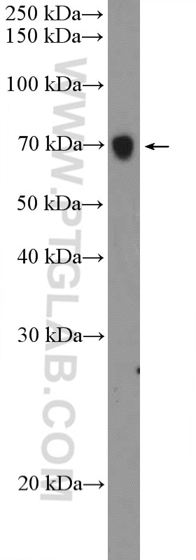 Western Blot (WB) analysis of A375 cells using PODN Polyclonal antibody (15014-1-AP)