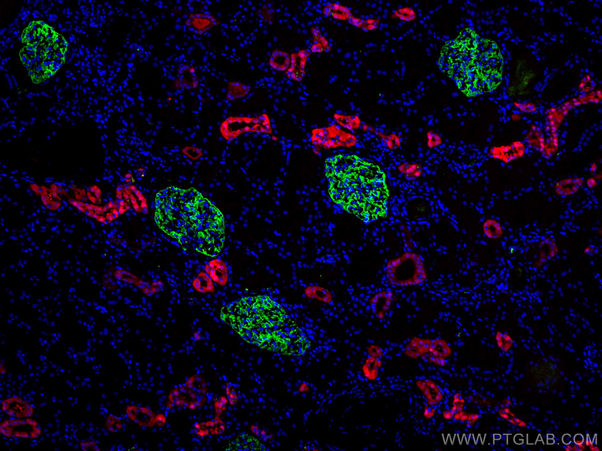 Immunofluorescence (IF) / fluorescent staining of human kidney tissue using Podocalyxin Polyclonal antibody (18150-1-AP)