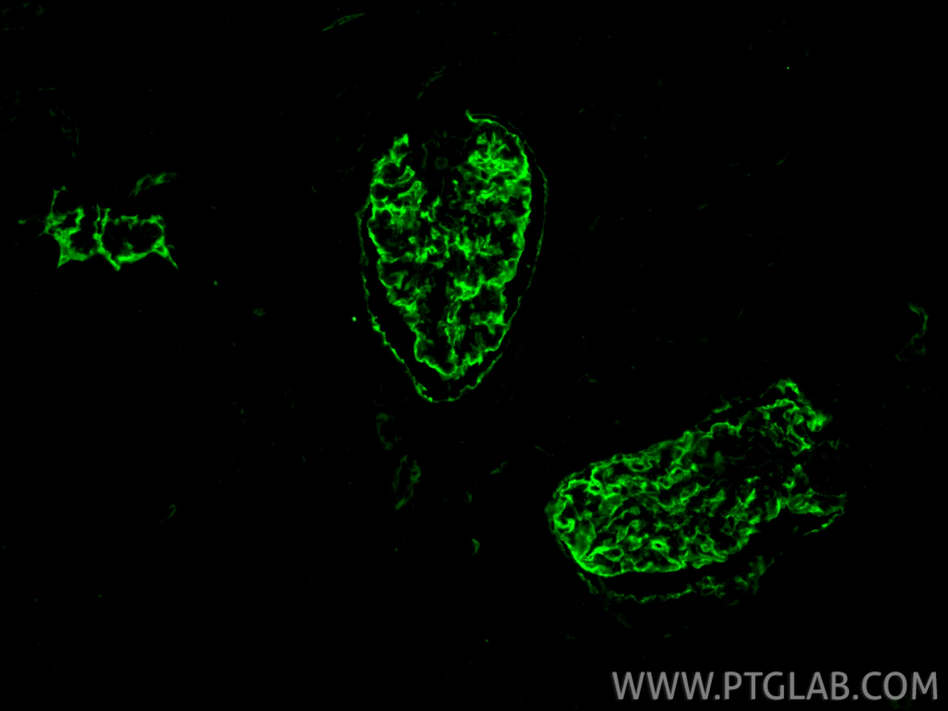 Immunofluorescence (IF) / fluorescent staining of human kidney tissue using Podocalyxin Polyclonal antibody (18150-1-AP)