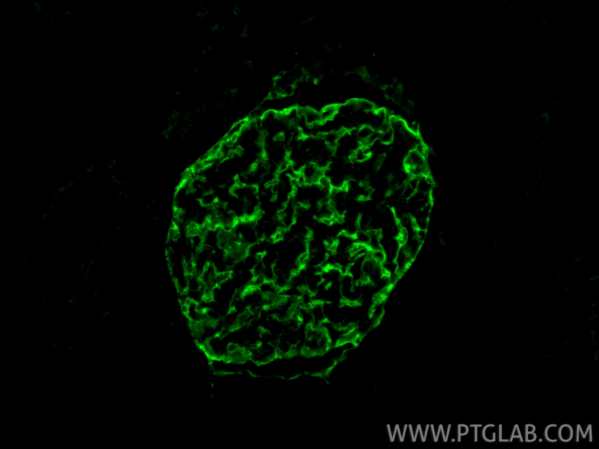 Immunofluorescence (IF) / fluorescent staining of human kidney tissue using Podocalyxin Polyclonal antibody (18150-1-AP)