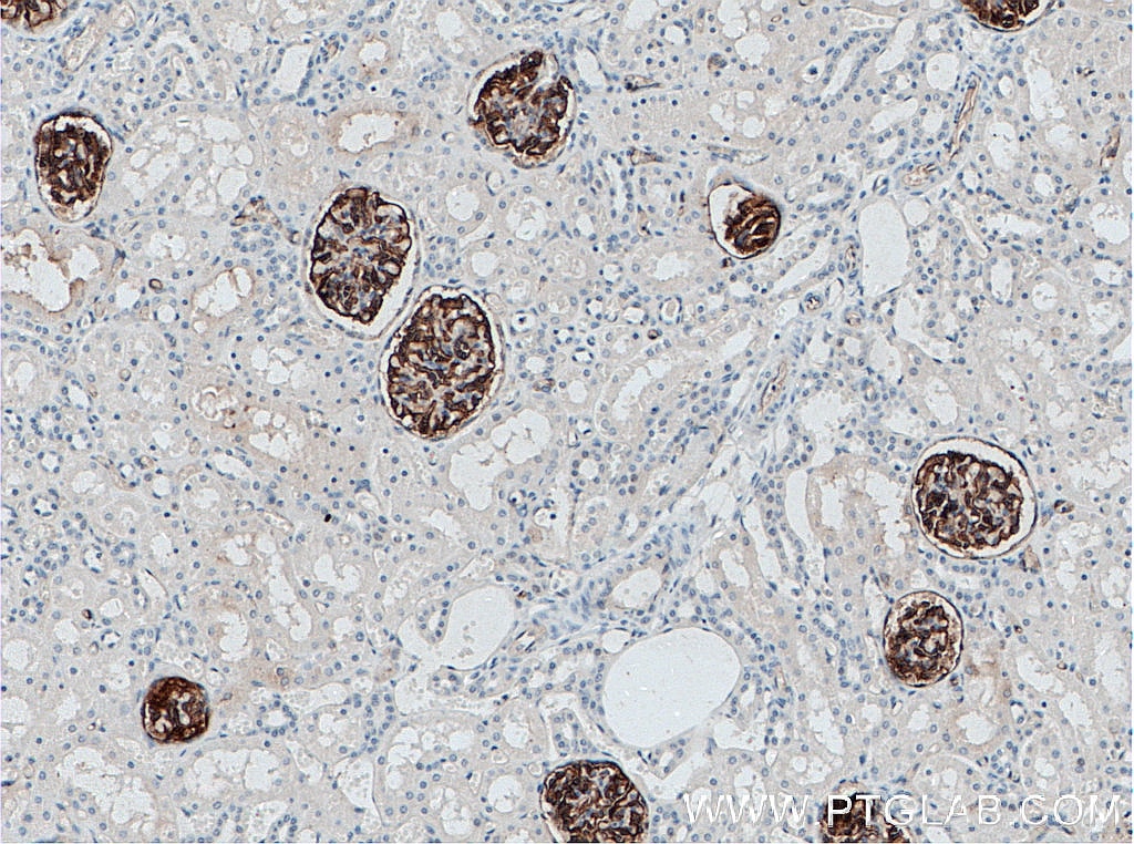 Immunohistochemistry (IHC) staining of human kidney tissue using Podocalyxin Polyclonal antibody (18150-1-AP)