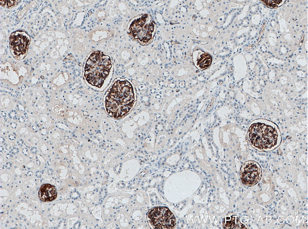 IHC staining of human kidney using 18150-1-AP