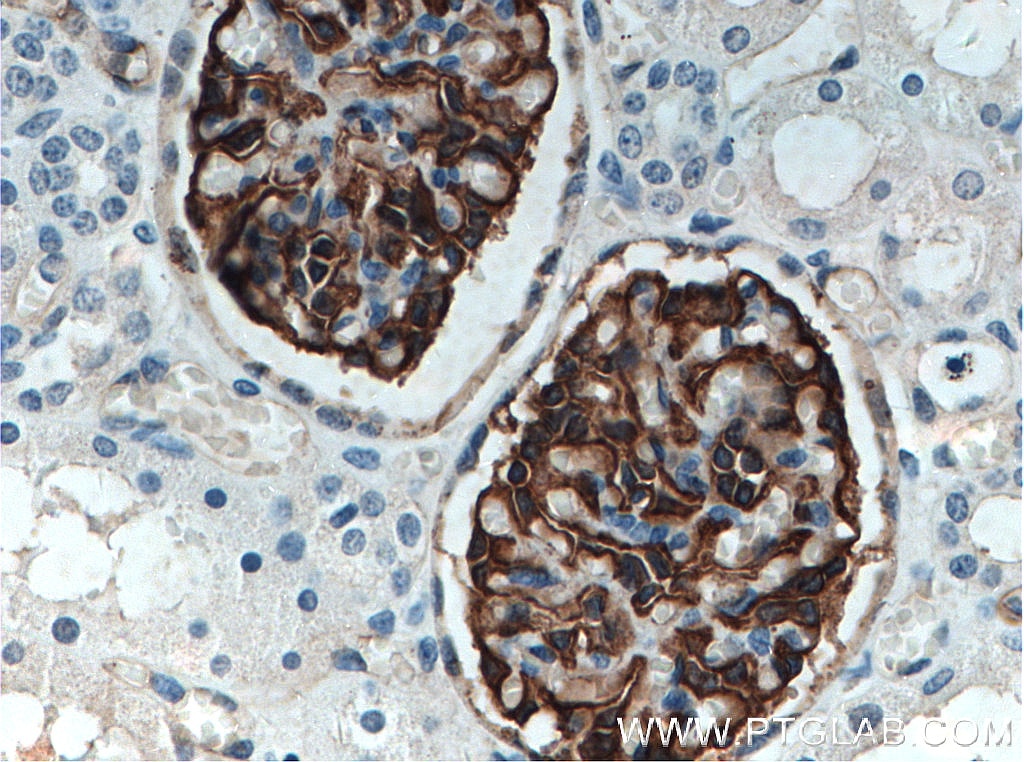 Immunohistochemistry (IHC) staining of human kidney tissue using Podocalyxin Polyclonal antibody (18150-1-AP)