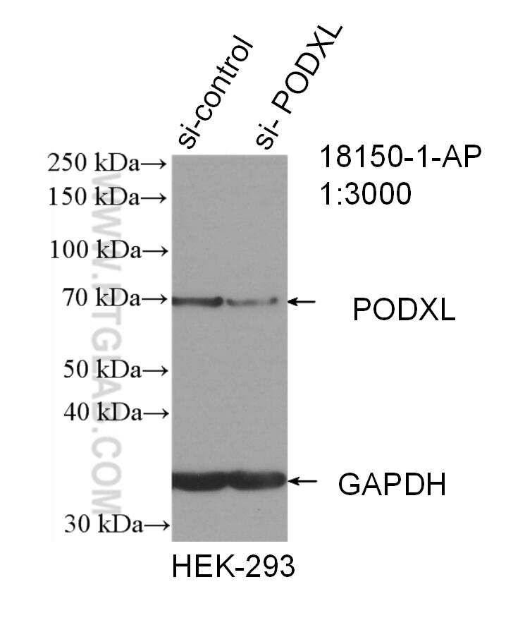 Western Blot (WB) analysis of HEK-293 cells using Podocalyxin Polyclonal antibody (18150-1-AP)