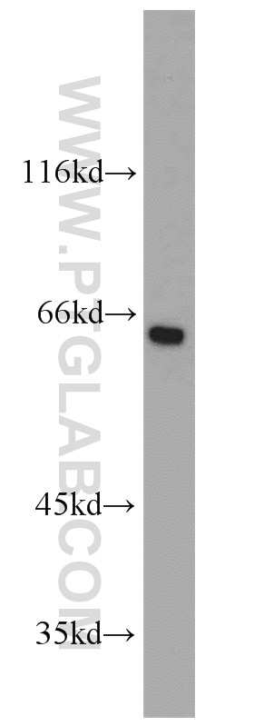 Western Blot (WB) analysis of HEK-293 cells using Podocalyxin Polyclonal antibody (18150-1-AP)