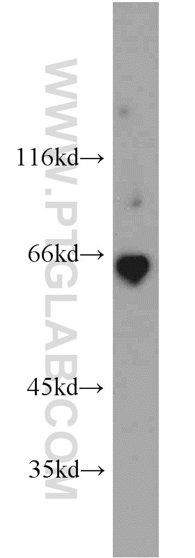 Western Blot (WB) analysis of human kidney tissue using Podocalyxin Polyclonal antibody (18150-1-AP)