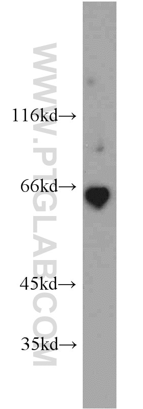 WB analysis of human kidney using 18150-1-AP