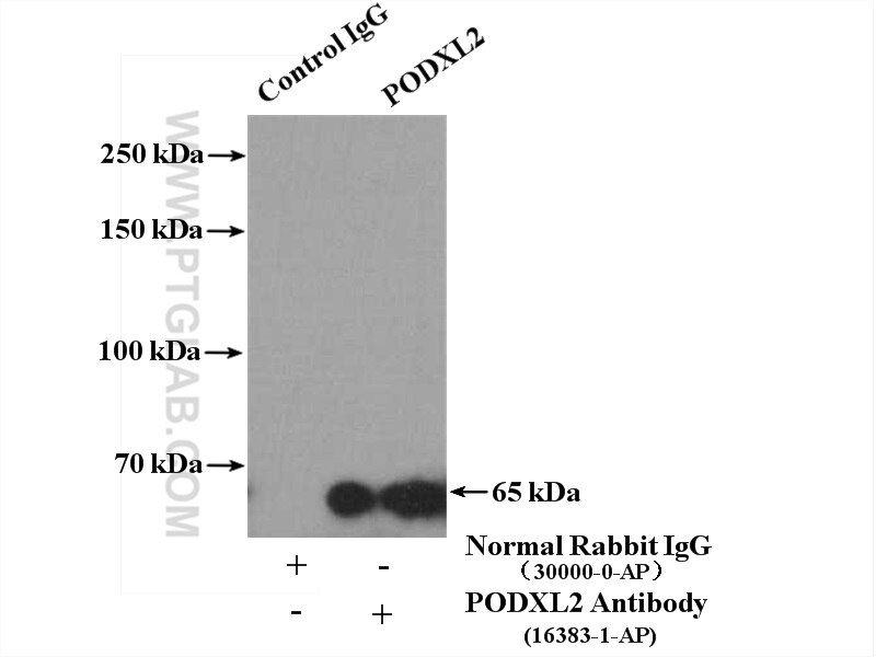 Immunoprecipitation (IP) experiment of K-562 cells using PODXL2 Polyclonal antibody (16383-1-AP)