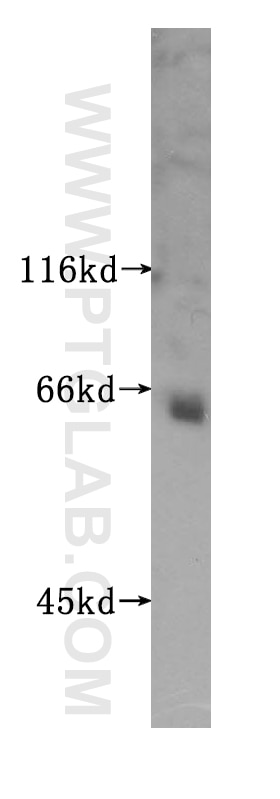 Western Blot (WB) analysis of mouse pancreas tissue using PODXL2 Polyclonal antibody (16383-1-AP)