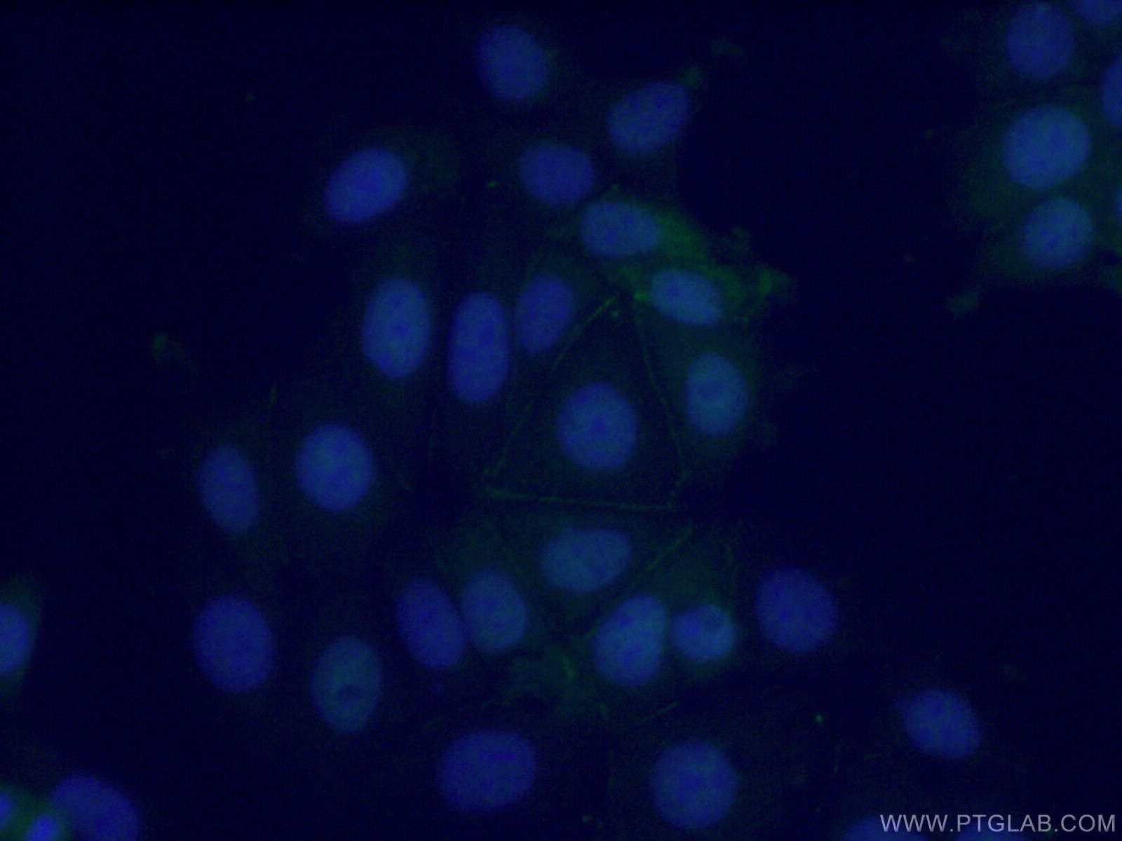 Immunofluorescence (IF) / fluorescent staining of MCF-7 cells using POF1B Polyclonal antibody (11398-1-AP)