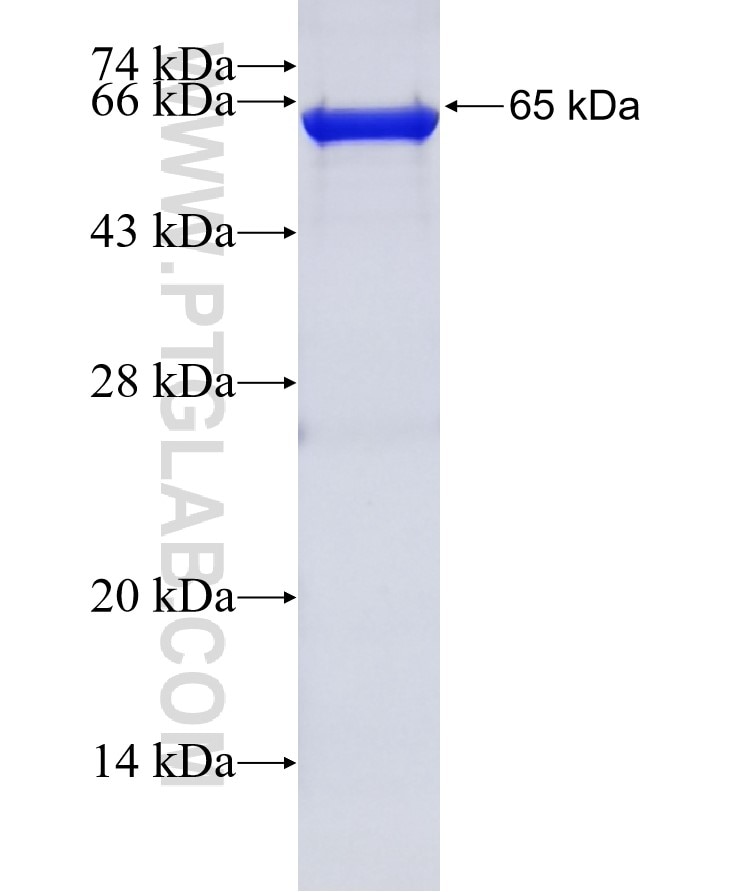 POF1B fusion protein Ag1945 SDS-PAGE