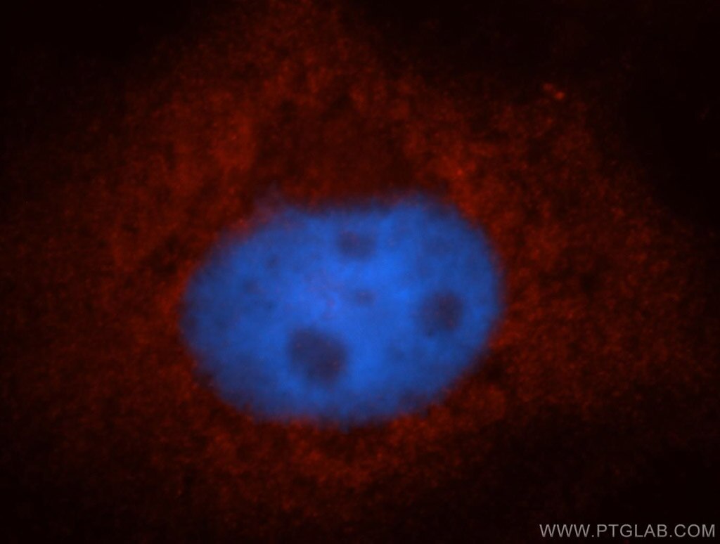 IF Staining of A431 using 14929-1-AP