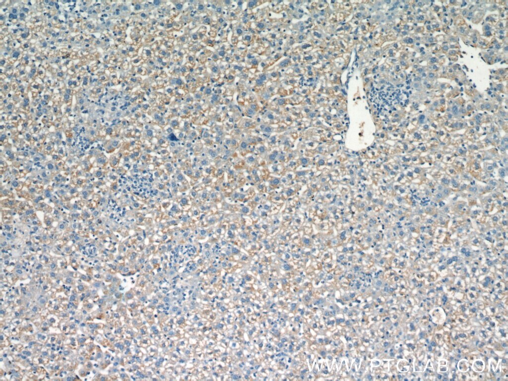 Immunohistochemistry (IHC) staining of mouse liver tissue using POFUT1 Polyclonal antibody (14929-1-AP)