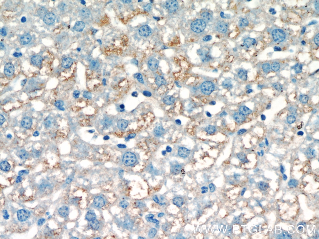 Immunohistochemistry (IHC) staining of mouse liver tissue using POFUT1 Polyclonal antibody (14929-1-AP)