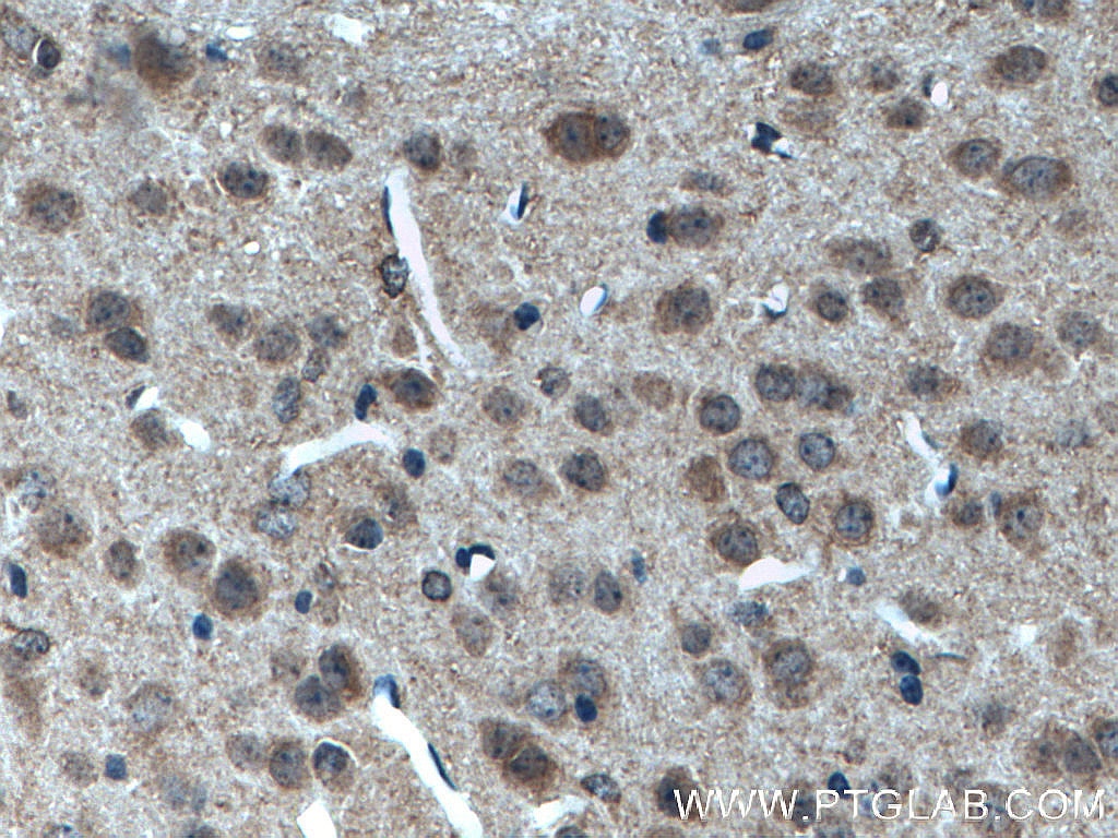Immunohistochemistry (IHC) staining of mouse brain tissue using POFUT2 Polyclonal antibody (17764-1-AP)