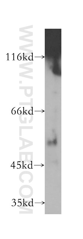 Western Blot (WB) analysis of mouse brain tissue using POFUT2 Polyclonal antibody (17764-1-AP)