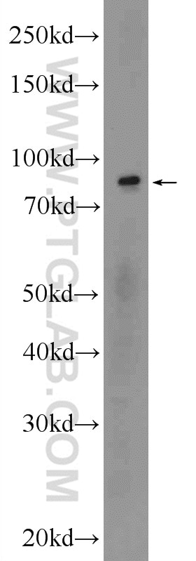Western Blot (WB) analysis of human testis tissue using POGK Polyclonal antibody (24888-1-AP)