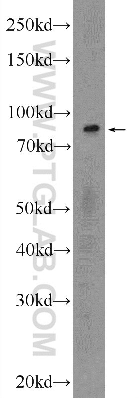 Western Blot (WB) analysis of human testis tissue using POGK Polyclonal antibody (24888-1-AP)