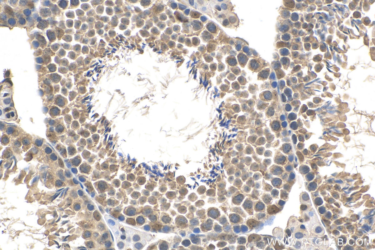 Immunohistochemistry (IHC) staining of mouse testis tissue using POGZ Polyclonal antibody (30106-1-AP)