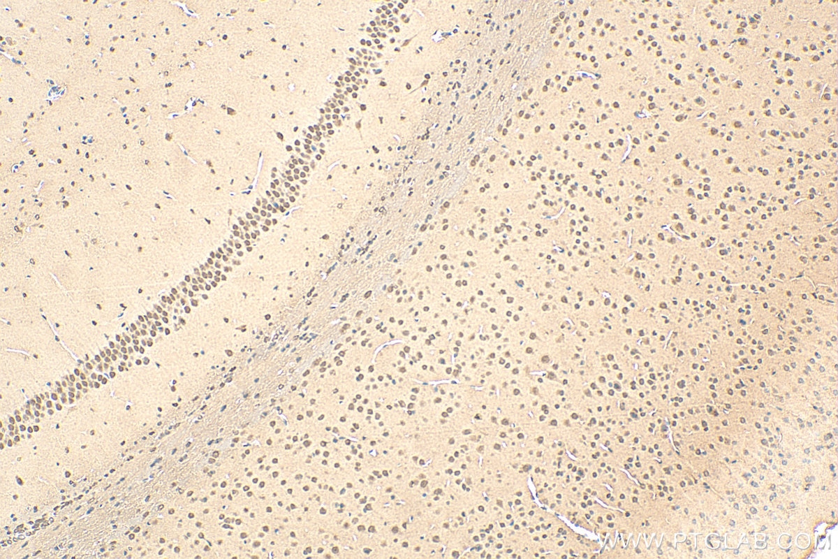 Immunohistochemistry (IHC) staining of mouse brain tissue using POGZ Polyclonal antibody (30106-1-AP)