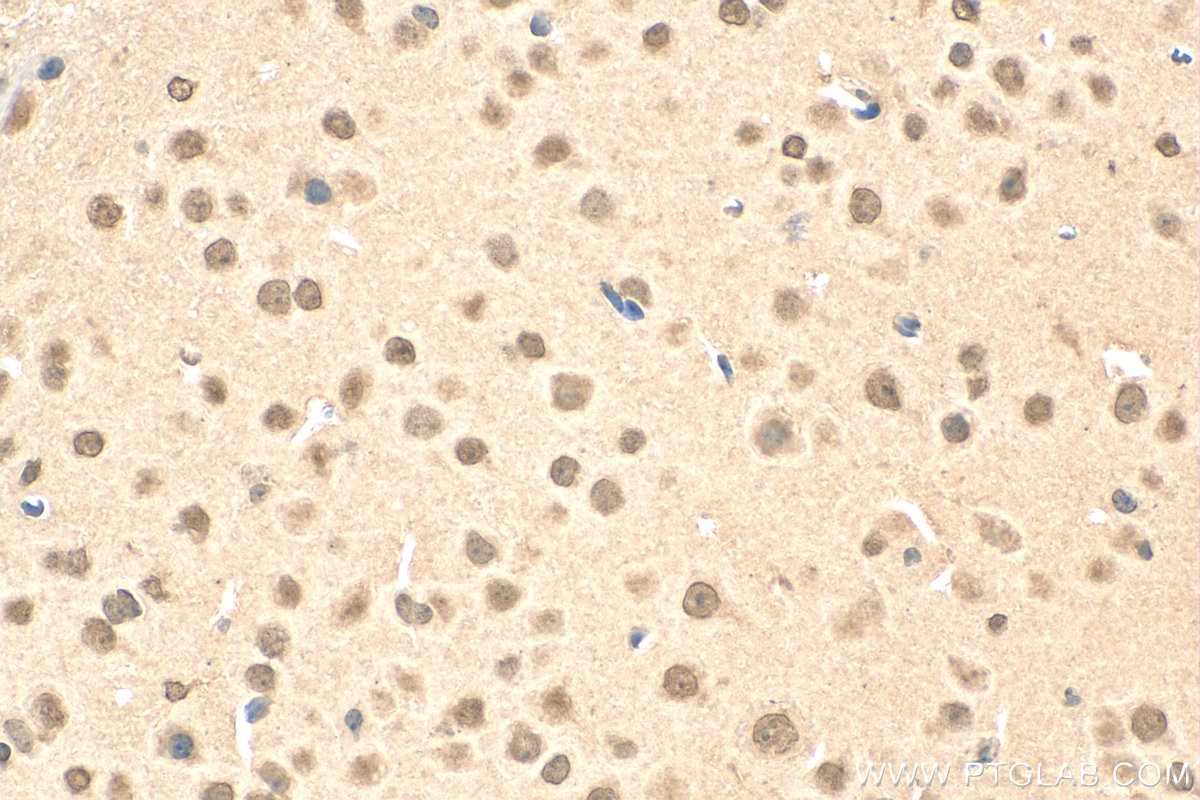 Immunohistochemistry (IHC) staining of mouse brain tissue using POGZ Polyclonal antibody (30106-1-AP)