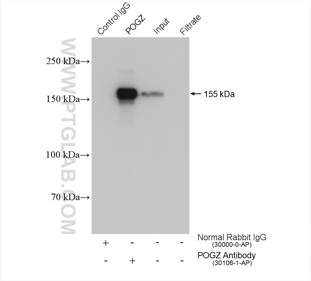 Immunoprecipitation (IP) experiment of HeLa cells using POGZ Polyclonal antibody (30106-1-AP)