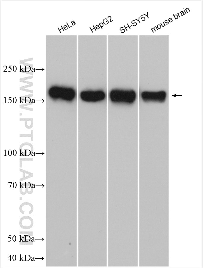 Western Blot (WB) analysis of various lysates using POGZ Polyclonal antibody (30106-1-AP)