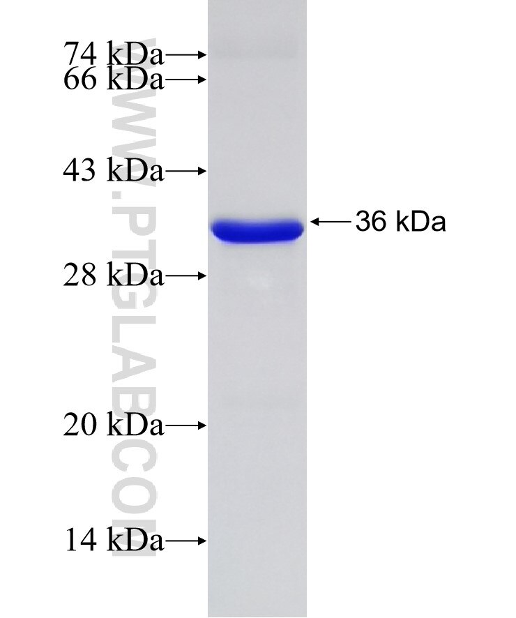 POGZ fusion protein Ag32406 SDS-PAGE