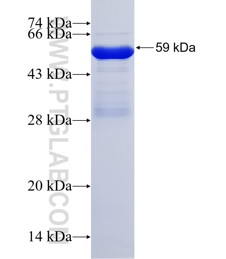 POGZ fusion protein Ag32435 SDS-PAGE