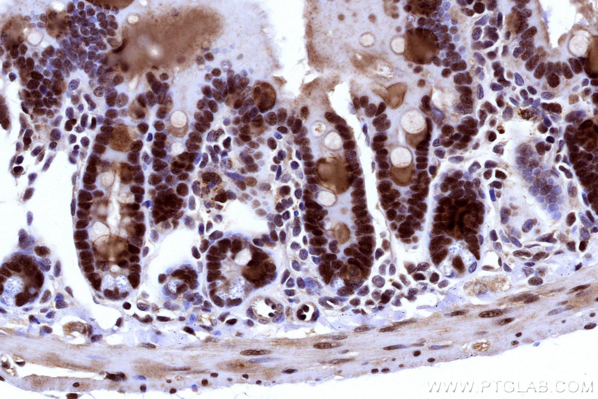 IHC staining of mouse small intestine using 31394-1-AP Immunohistochemistry (IHC) staining of mouse small intestine tissue using POLA1 Polyclonal antibody (31394-1-AP)