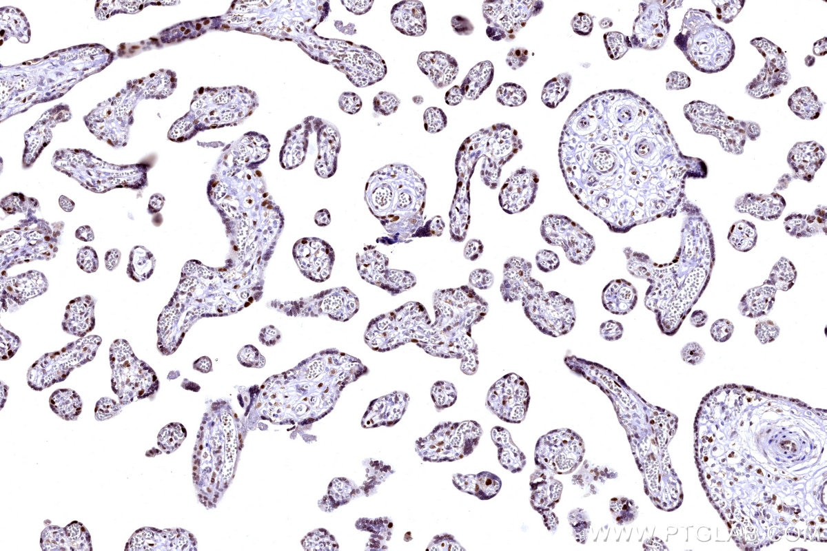 IHC staining of human placenta using 31394-1-AP Immunohistochemistry (IHC) staining of human placenta tissue using POLA1 Polyclonal antibody (31394-1-AP)