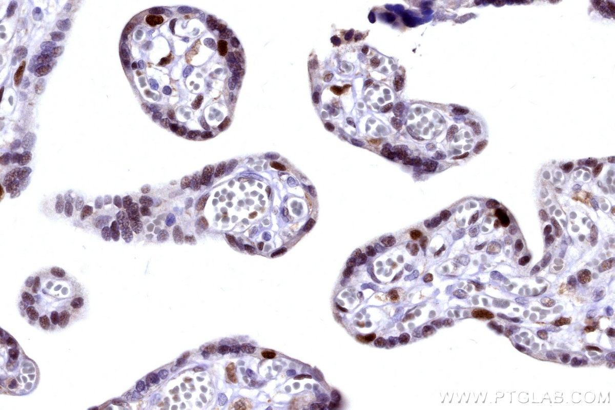 IHC staining of human placenta using 31394-1-AP Immunohistochemistry (IHC) staining of human placenta tissue using POLA1 Polyclonal antibody (31394-1-AP)