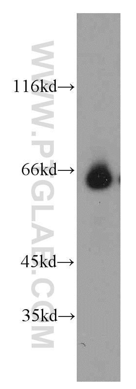 POLA2