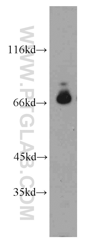 Western Blot (WB) analysis of HeLa cells using POLA2 Polyclonal antibody (21778-1-AP)