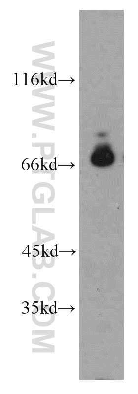 WB analysis of HeLa using 21778-1-AP