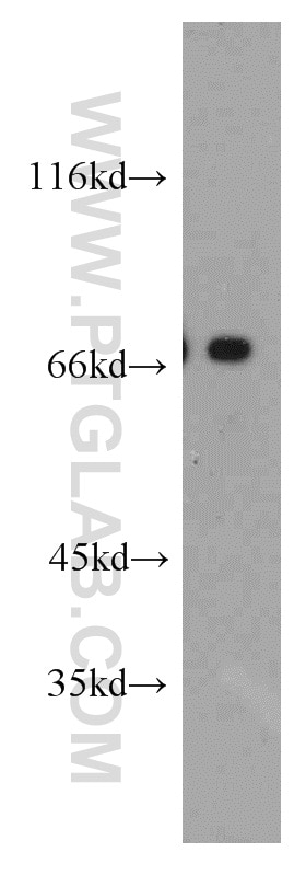 Western Blot (WB) analysis of HeLa cells using POLA2 Polyclonal antibody (21778-1-AP)