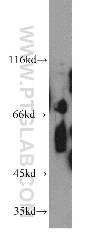 Western Blot (WB) analysis of COLO 320 cells using POLA2 Polyclonal antibody (21778-1-AP)